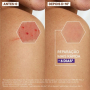 A-Derma Epitheliale Ultra Repair Creme Reparador Antimarcas 40ml
