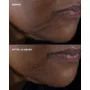 Clinique Smart Clinical Repair Lifting Creme Rosto e Pescoço 50ml