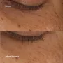 Clinique All About Eyes Brightening Serum Concentrate Serum Iluminador Olhos com Retinoide 10ml